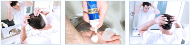 img-rogaine-products-apply-body (2)(1) Rogaine